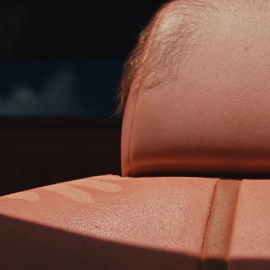 Australian Company Sheds Light On In-Car Sun Exposure By Reupholstering A Camry With Human-Like Skin That 'Burns' In Sunlight